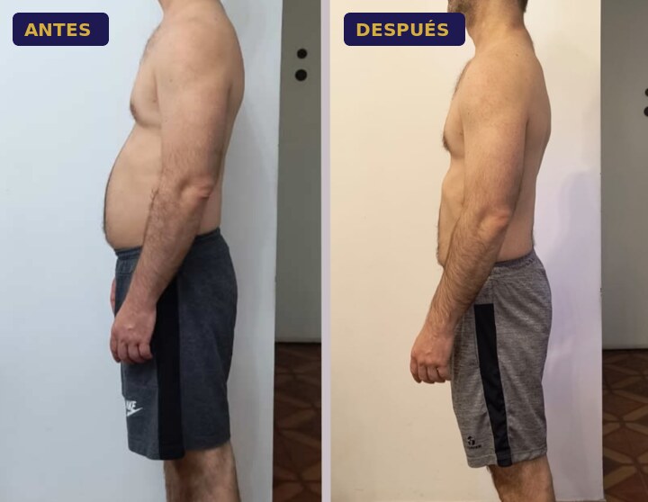Foto de antes y después de Alejandro
