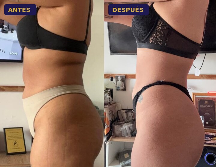 Foto de antes y después de Oriana